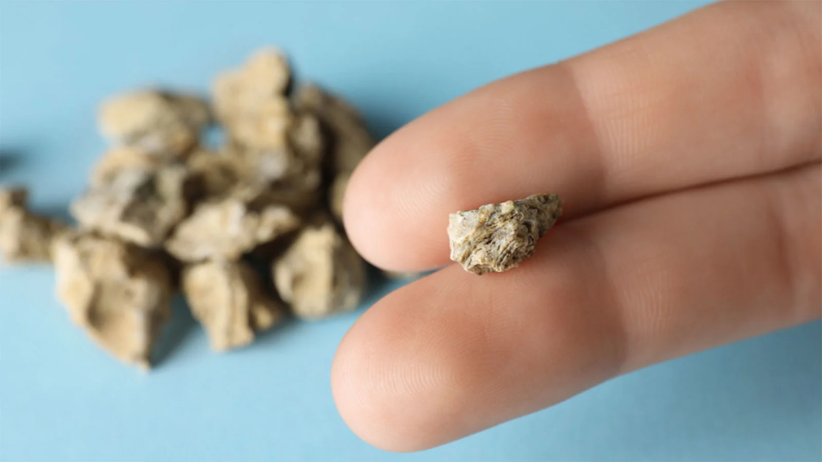 Cannabis & Kidney Stones: Causes, Risks, and Symptom Relief Featured Image